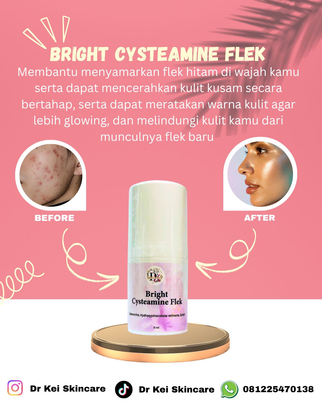 Dr Kei Beauty Care Bright Cysteamine Flek 15 Gr
